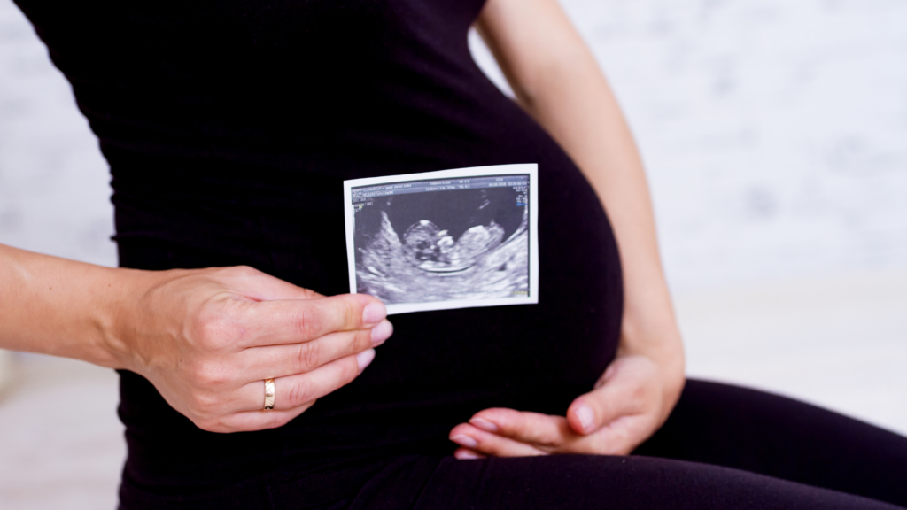 Air Pollution Causes Harm to Fetus 1