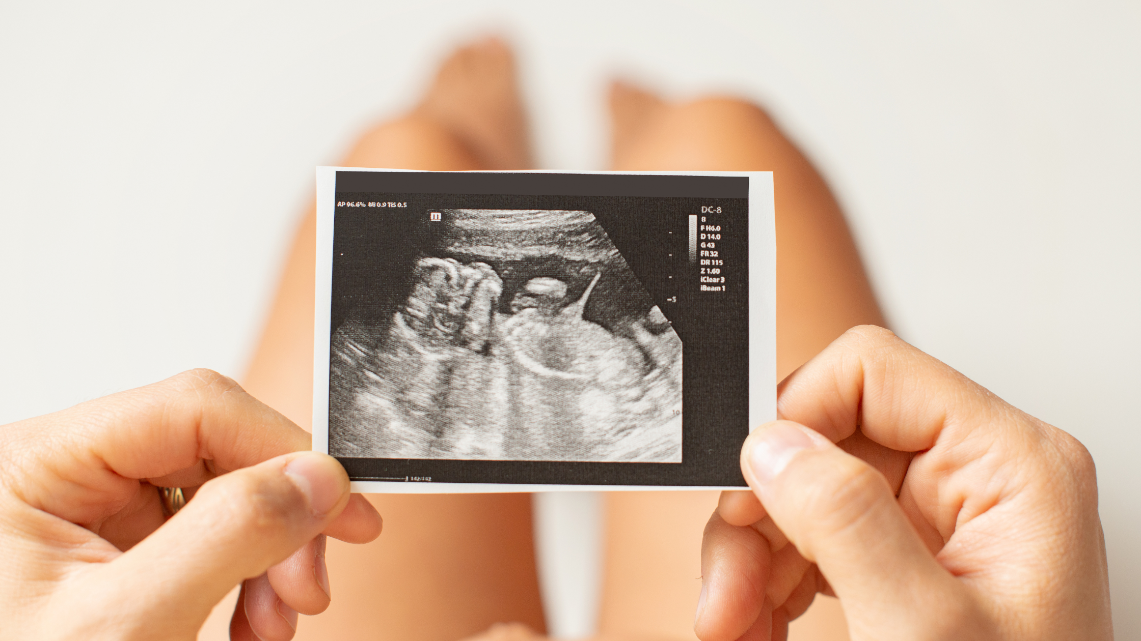 Maternal Exposure To Air Pollution May Raise The Risk For Heart Defects In An Unborn Child